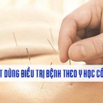 80 huyet dao theo y hoc co truyen