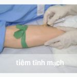 0-tiem-tinh-mach.23.5