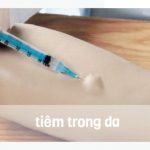 tiem-trong-da 23.5
