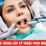 Dao-tao-trung-cap-ky-thuat-phuc-hinh-rang-pasteur